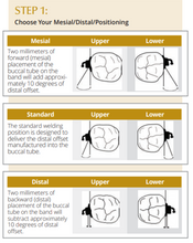 Supra™ Firm Molar Band pre-weld, with Double Convertible, .045 Occlusal