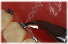 Everfine Lingual Pin & Ligature Cutter, 50 degree