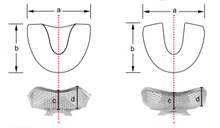 Impression Tray Set, Stainless Steel Net (Full Arch)
