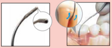 Diamond Coated File Scalers Nabers